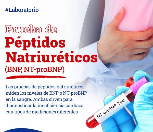 Estudio BNP - precio en Salud Digna, Chopo y Olab