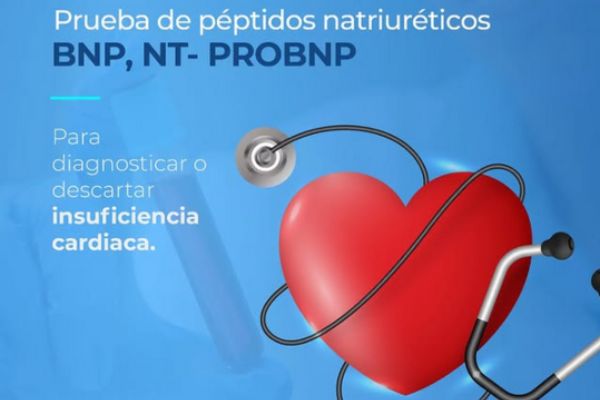 Qué es el estudio BNP precio en Salud Digna, Chopo y Olab