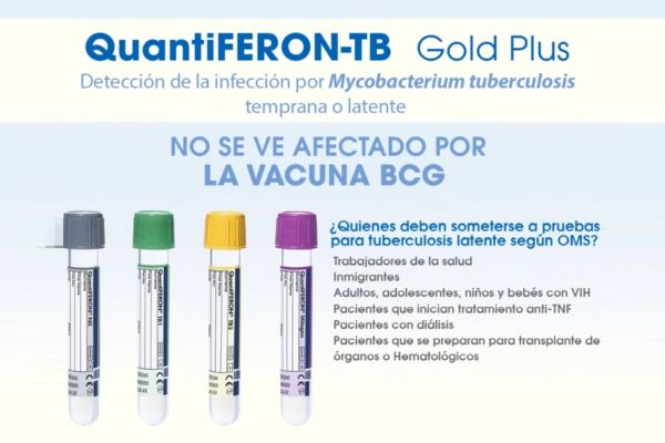 Qué es y qué significa Quantiferon TB Gold_ precio en Salud Digna, Chopo y Olab